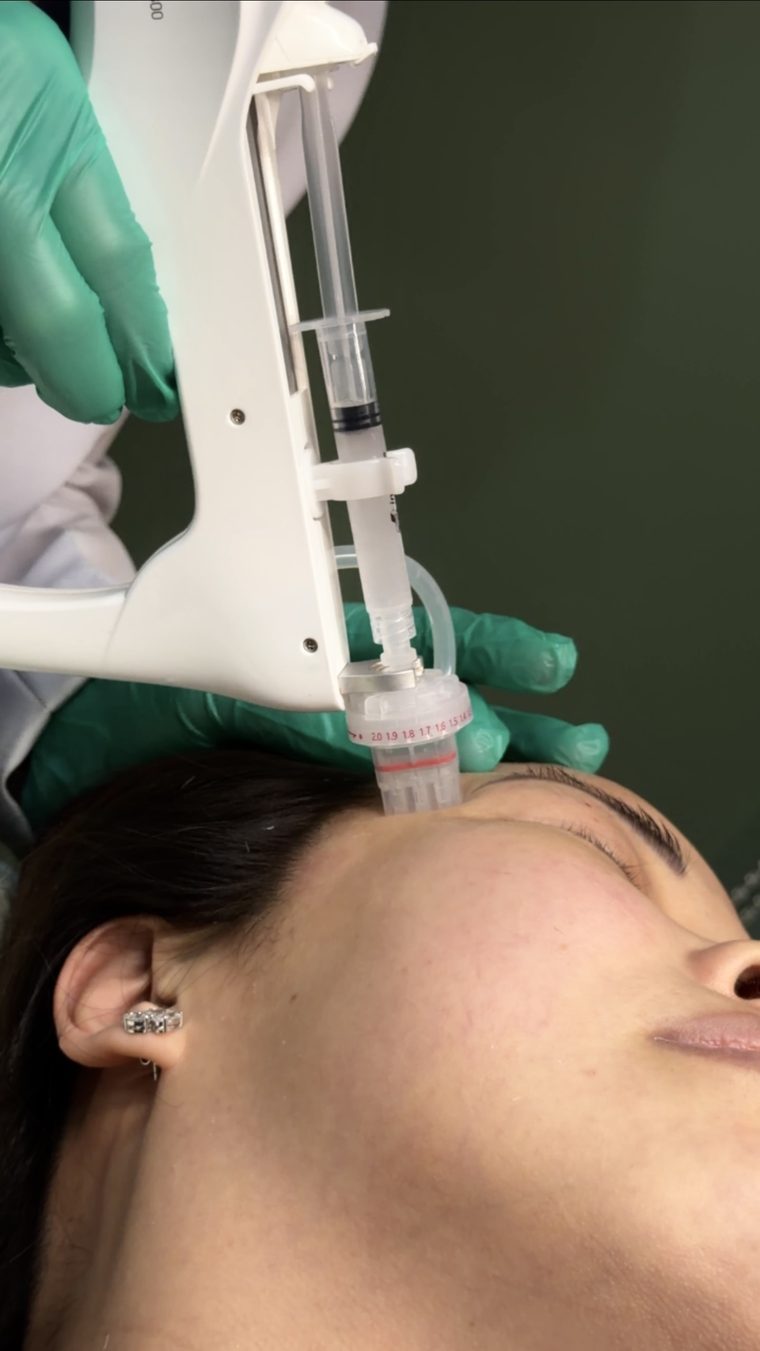 Dermatologist performing a skin booster treatment at Skinstitute in Quezon City.